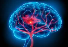 Coma Diagnosis and Treatment Industry Forecast Report, 2028
