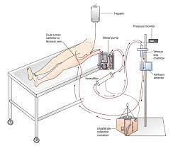 Continuous Renal Replacement Therapy Market Analysis & Growth