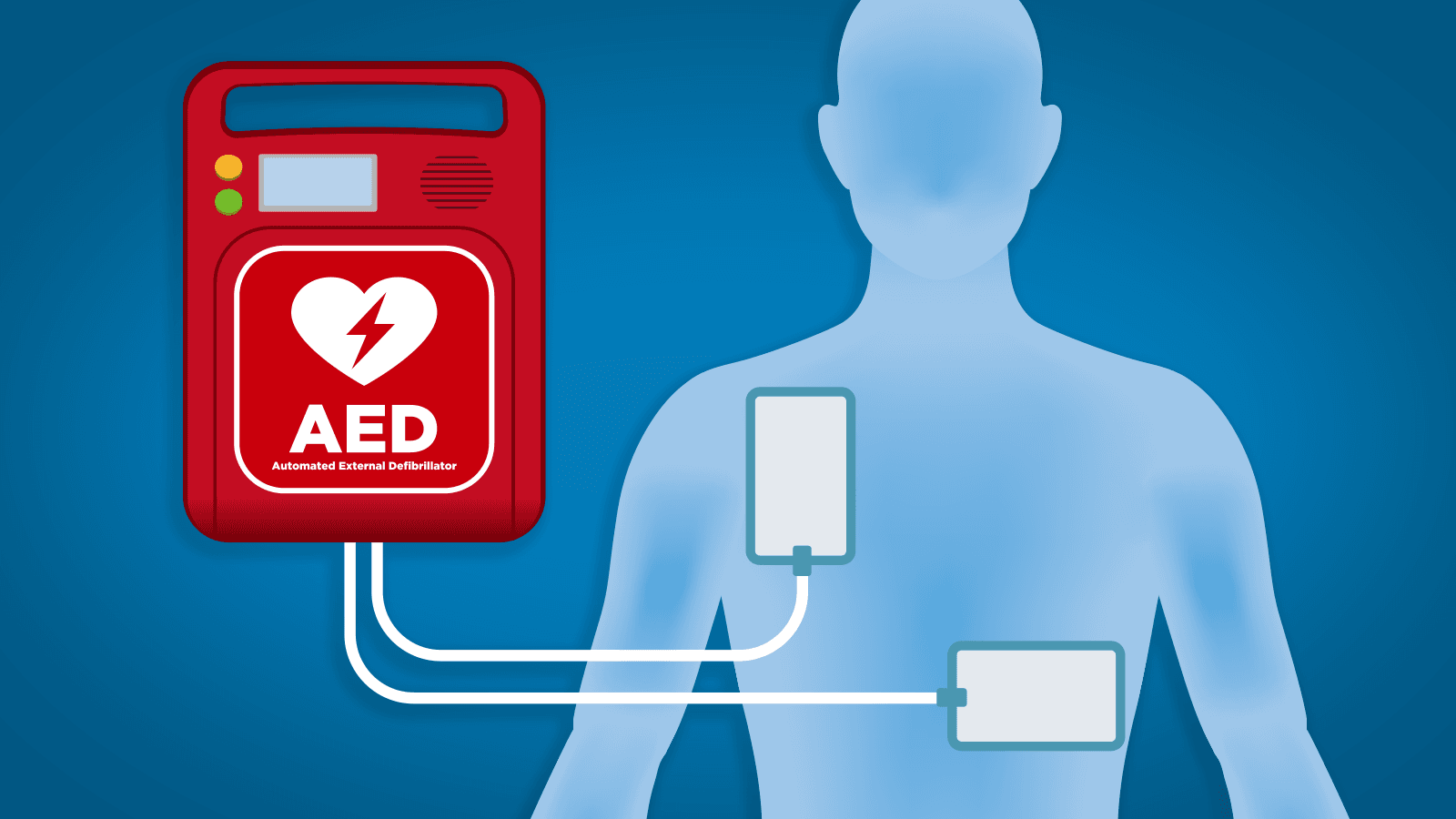 Defibrillators Market Key Players & Industry Analysis Till 2028
