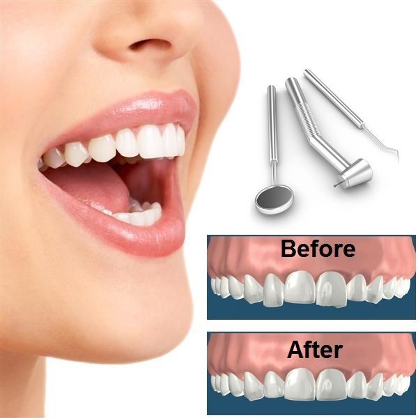 Dental Contouring Market | Global Industry Segmentation to 2028