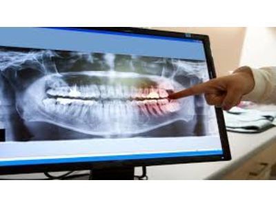Dental Imaging Market: Global Analysis, Size, Share, Growth, 2030