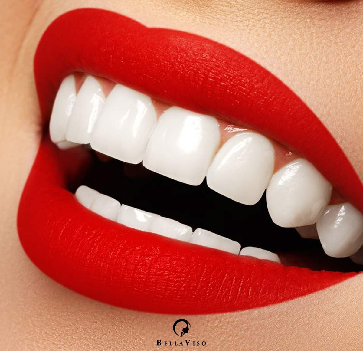 Unveil excellence:the Best Teeth Cleaning Medical Center in Dubai