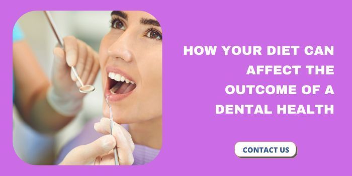 How Your Diet Can Affect the Outcome of a Dental Check-Up