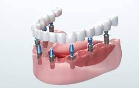 How to Choose the Right Dental Clinic in Perth for Your Family