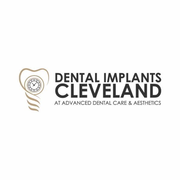 Full Mouth Dental Implants Cleveland OH by Dental Implants Cleveland