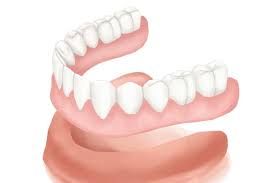 Denture Market 2022 Key Players and Industry Analysis Till 2028