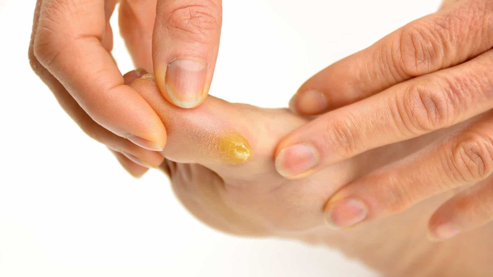 Diabetic Foot Care at Home in Dubai Daily Guide