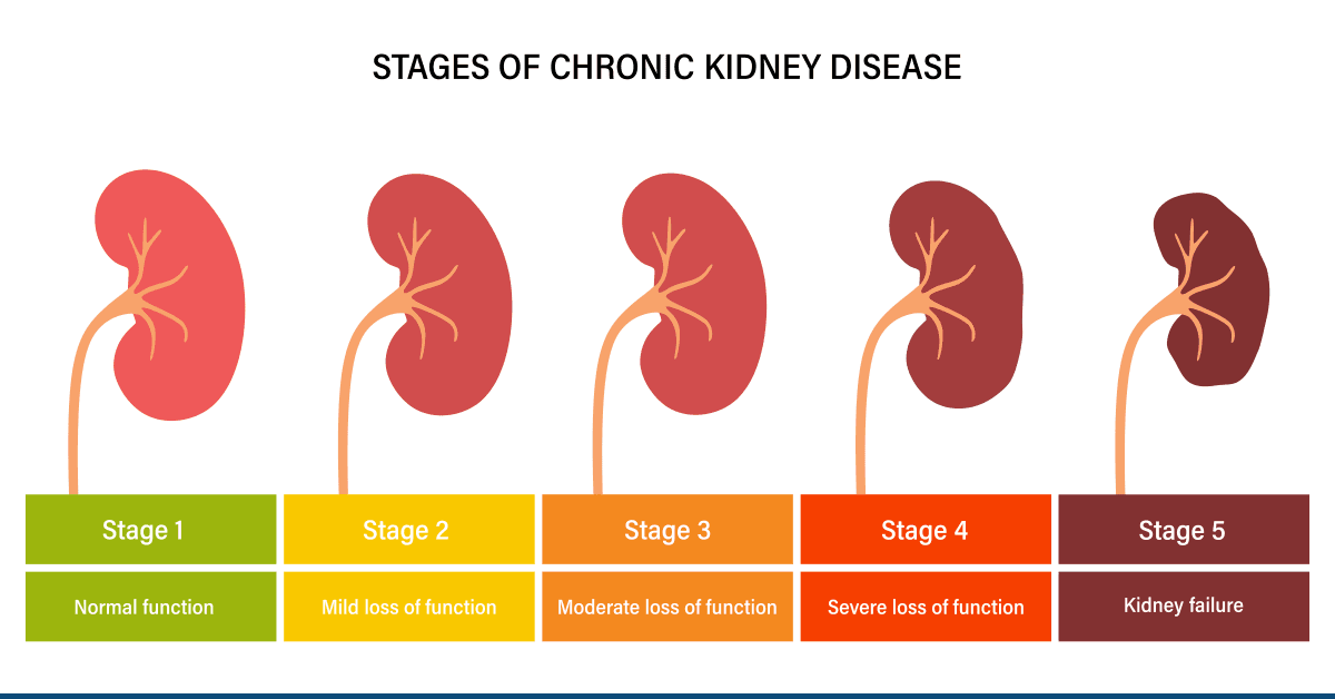 Understanding the Different Stages of Kidney Disease