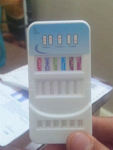 Drug Abuse Testing Market Industry Share 2028

