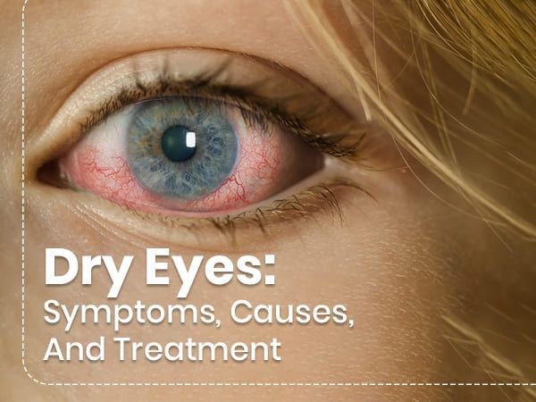 Dry Eye Syndrome Treatment Market Growth | Industry Analysis 