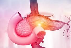 Exocrine Pancreatic Insufficiency Market Report