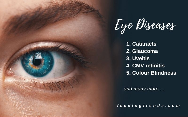 10 Eye Diseases That Are Common These Days