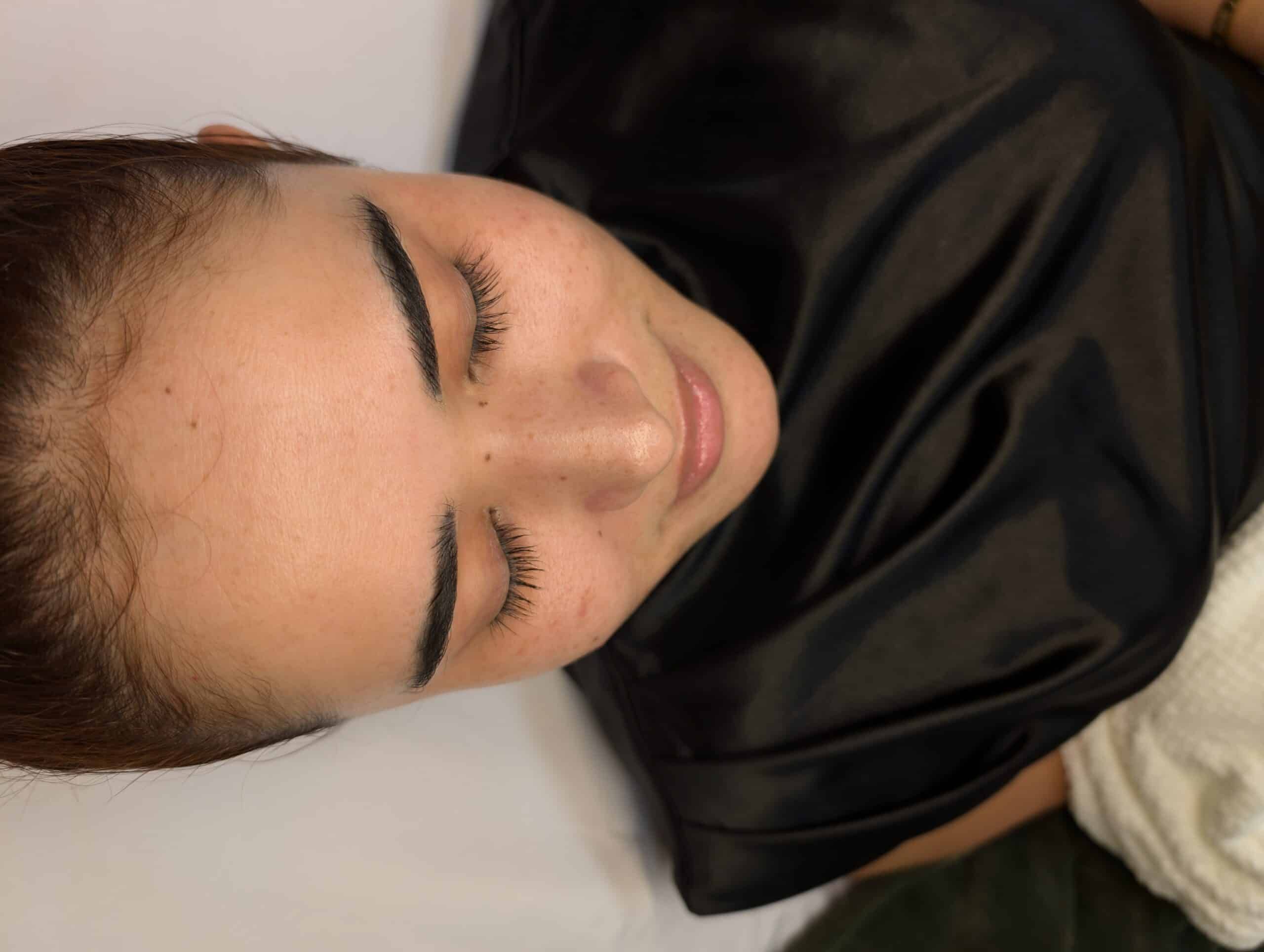 The Benefits of Professional Extractions in Wesley Chapel