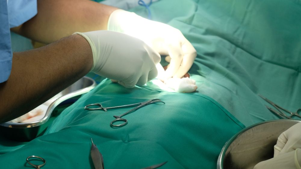 Factors That Raise Male circumcision surgery cost