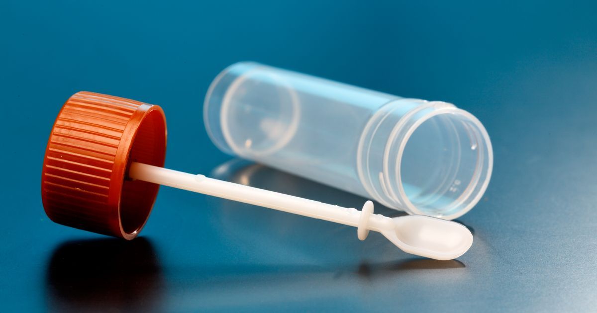 Faecal Calprotectin Testing Market Forecast Report, 2028