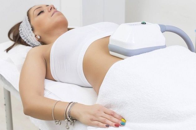 Fat Freezing Before and After: Real Patient Results