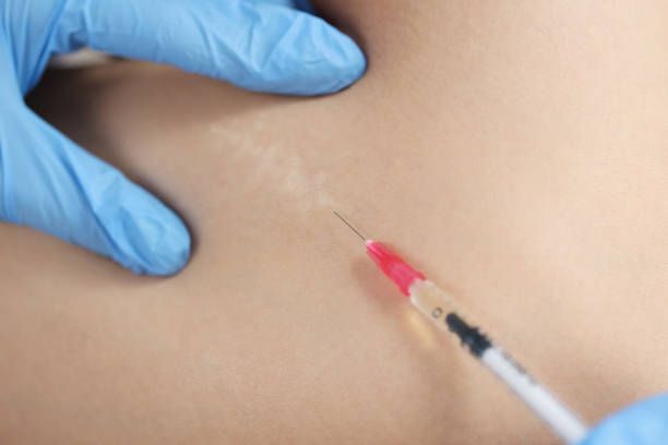 Redefine Your Features with Fat-Melting Injections in Dubai
