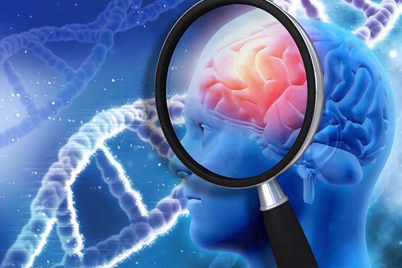 Frontotemporal Dementia Treatment Market 2022 Factors & Forecast