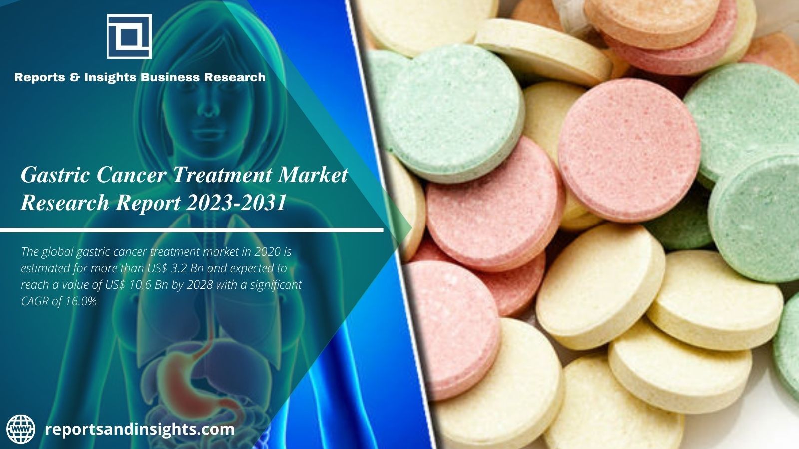 Gastric Cancer Treatment Market Is Expand at a Cagr of 16.0% 2031