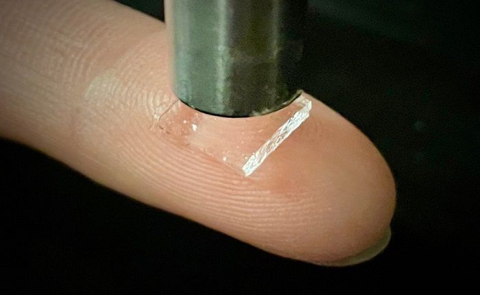 Bioadhesives Market by Demand, Price, Challenges, Growth, Players