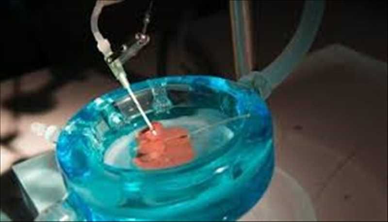 Global Organ Preservation Market Report by Size, Research, Shares