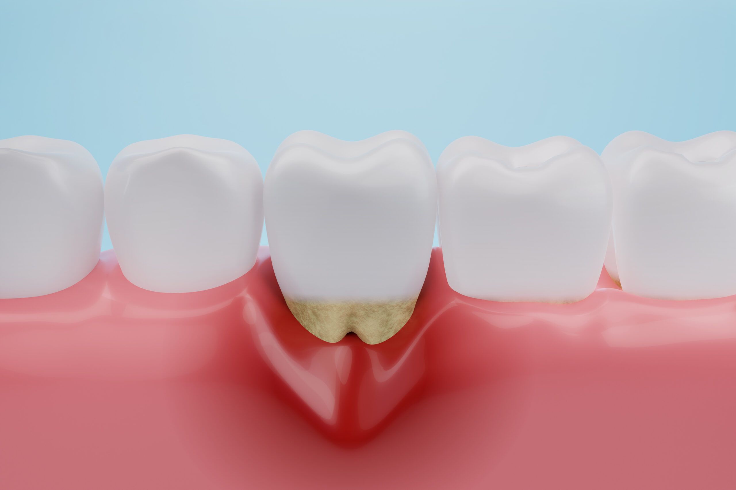 Does a gum infection smell?