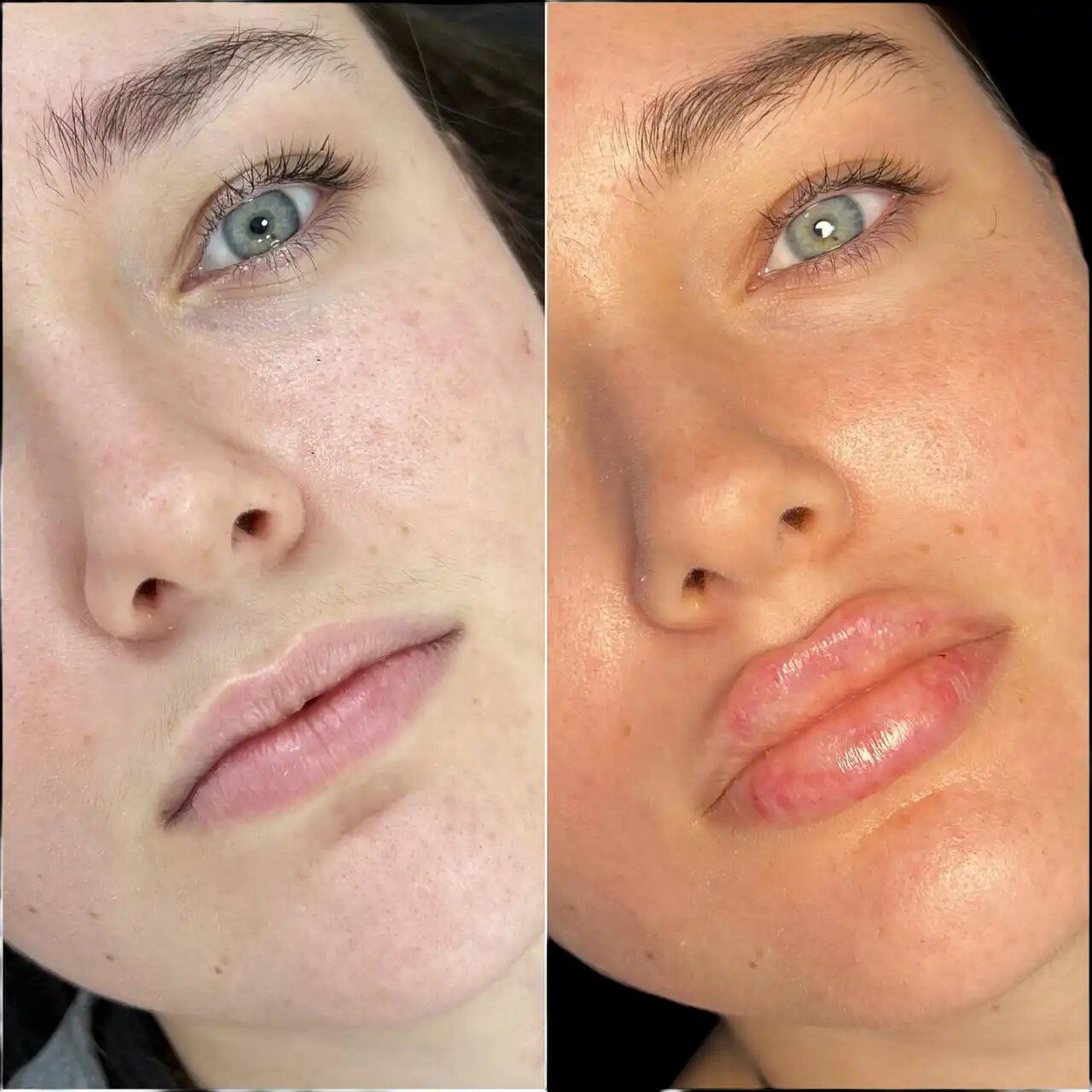 Best Aesthetic Clinic in dubai for Fillers the Right Choice for You