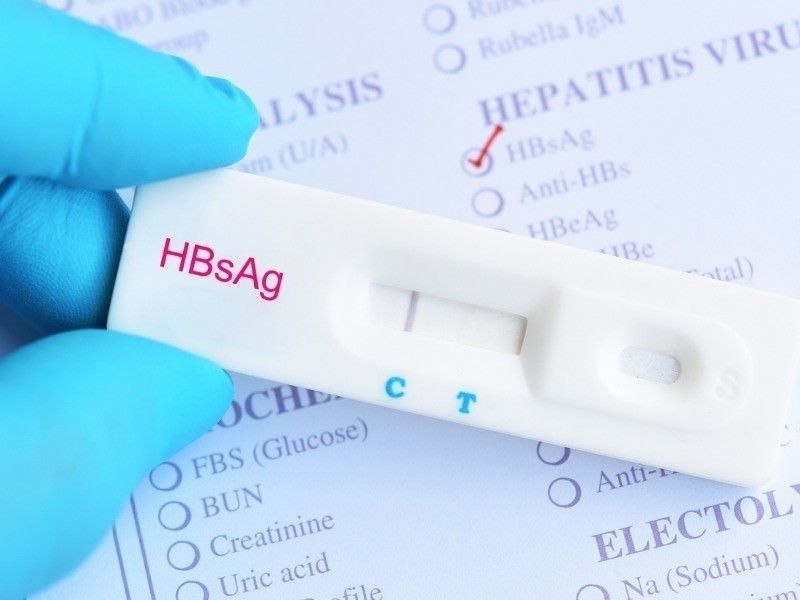 Hbsag Testing Market Size, Industry Share | Forecast, 2028