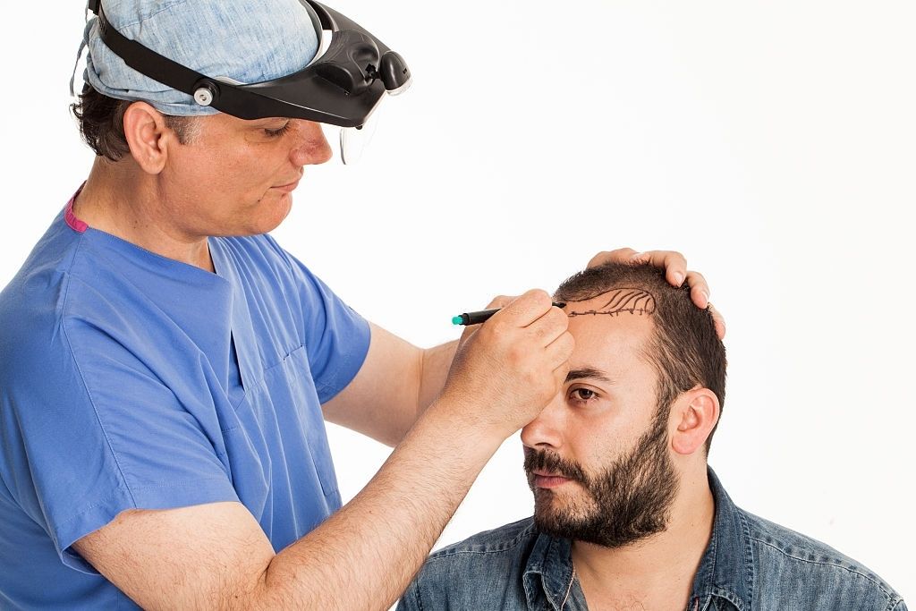 Reviews and Ratings of Hair Transplant Providers in Islamabad