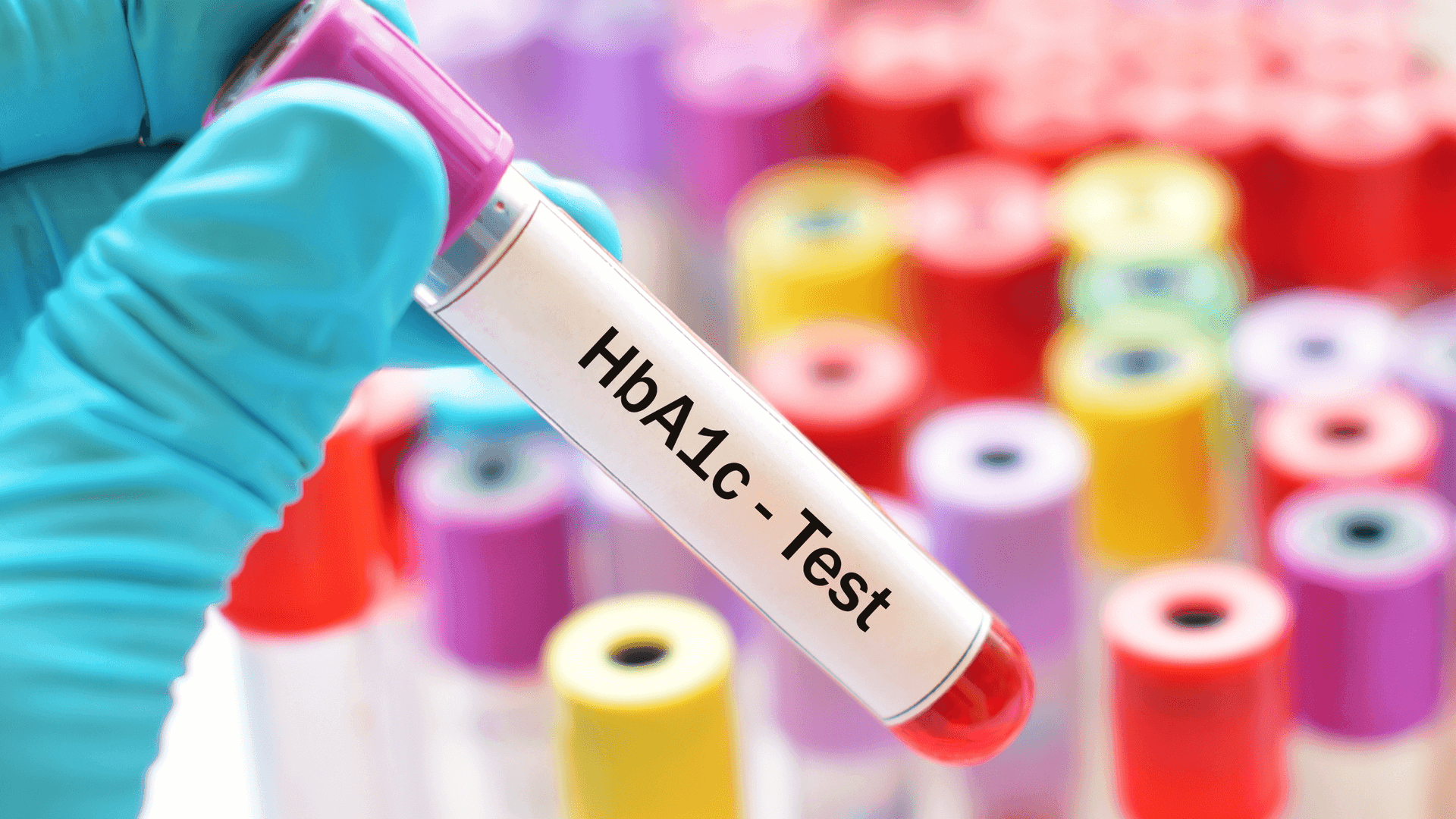 Hba1c Testing Market Trends, Share & Forecast Report to 2028