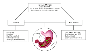 Helicobacter Pylori Non-Invasive Testing Market Industry Analysis