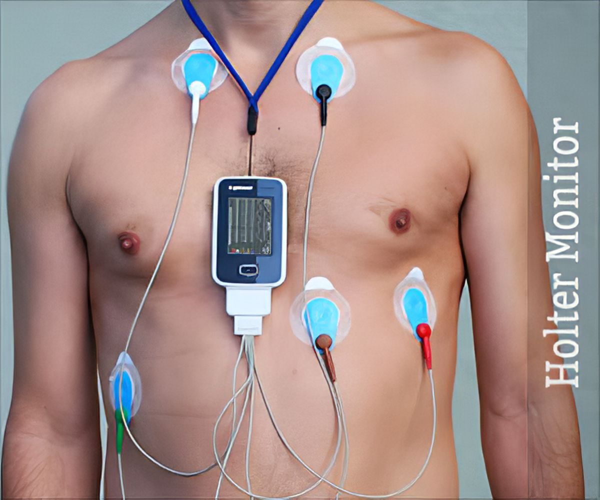 Holter Ecg Monitor Market Size, Analysis Report 2022-2028

