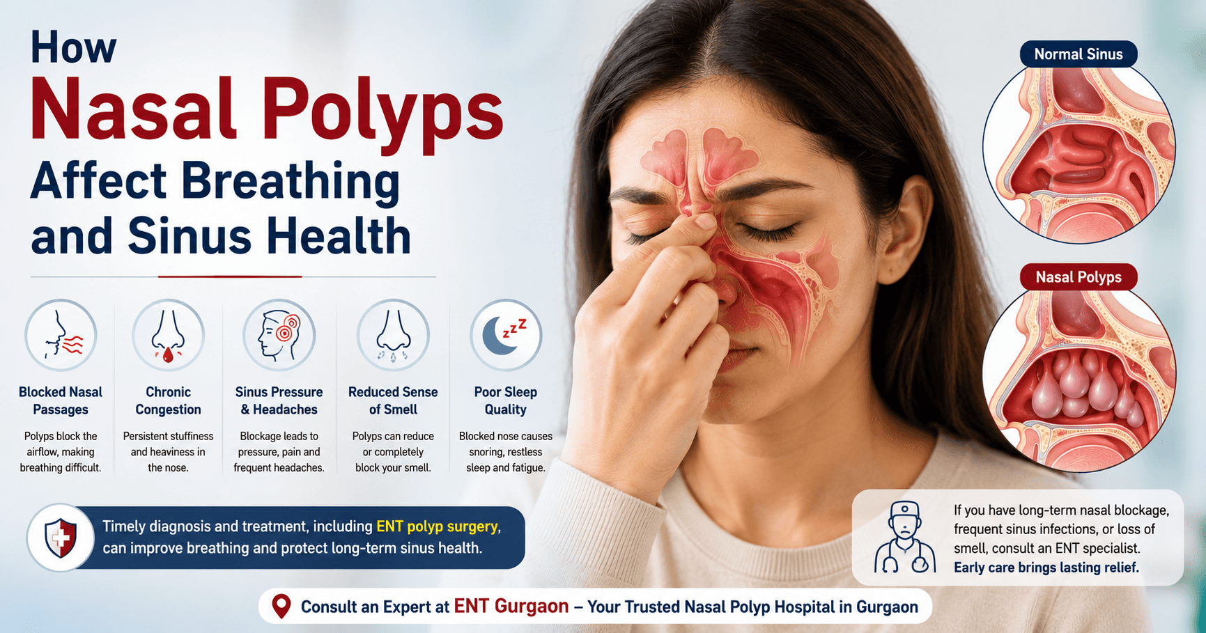 ENT polyp surgery in Gurgaon, Polyp removal Surgery in Gurgaon, Nasal polyp Hospital in Gurgaon