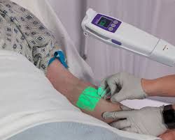 The Advantages of Vein Finders With Difficult Venous Access