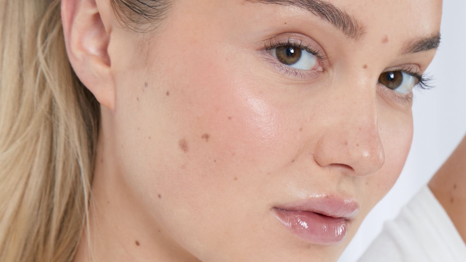 How to Choose the Right Skin Whitening Method