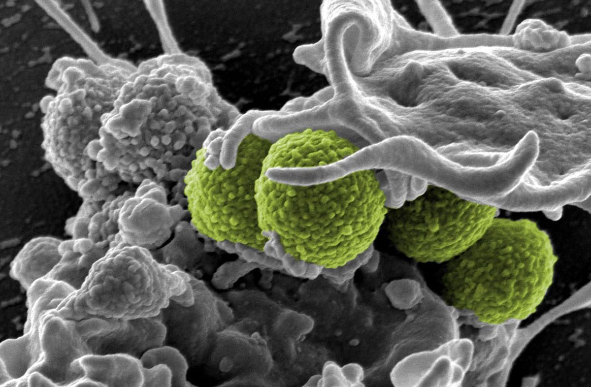 Human Bacterial Vaccine Market Players Analysis Report Till 2028
