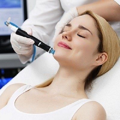 Benefits of HydraFacial for Acne-Prone Skin