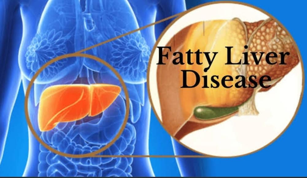 10 Diseases of Liver That You Should Be Aware Of