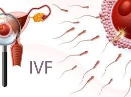 A Guide to Ivf Treatment With a Skilled Doctor