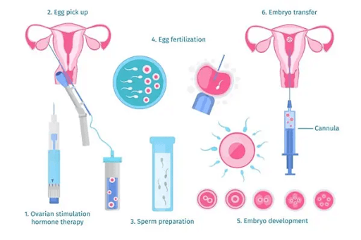 Ivf Treatment Options Available at Ivf Centers in Jaipur