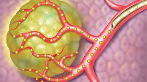 Interventional Oncology Market Size & Forecast to 2028
