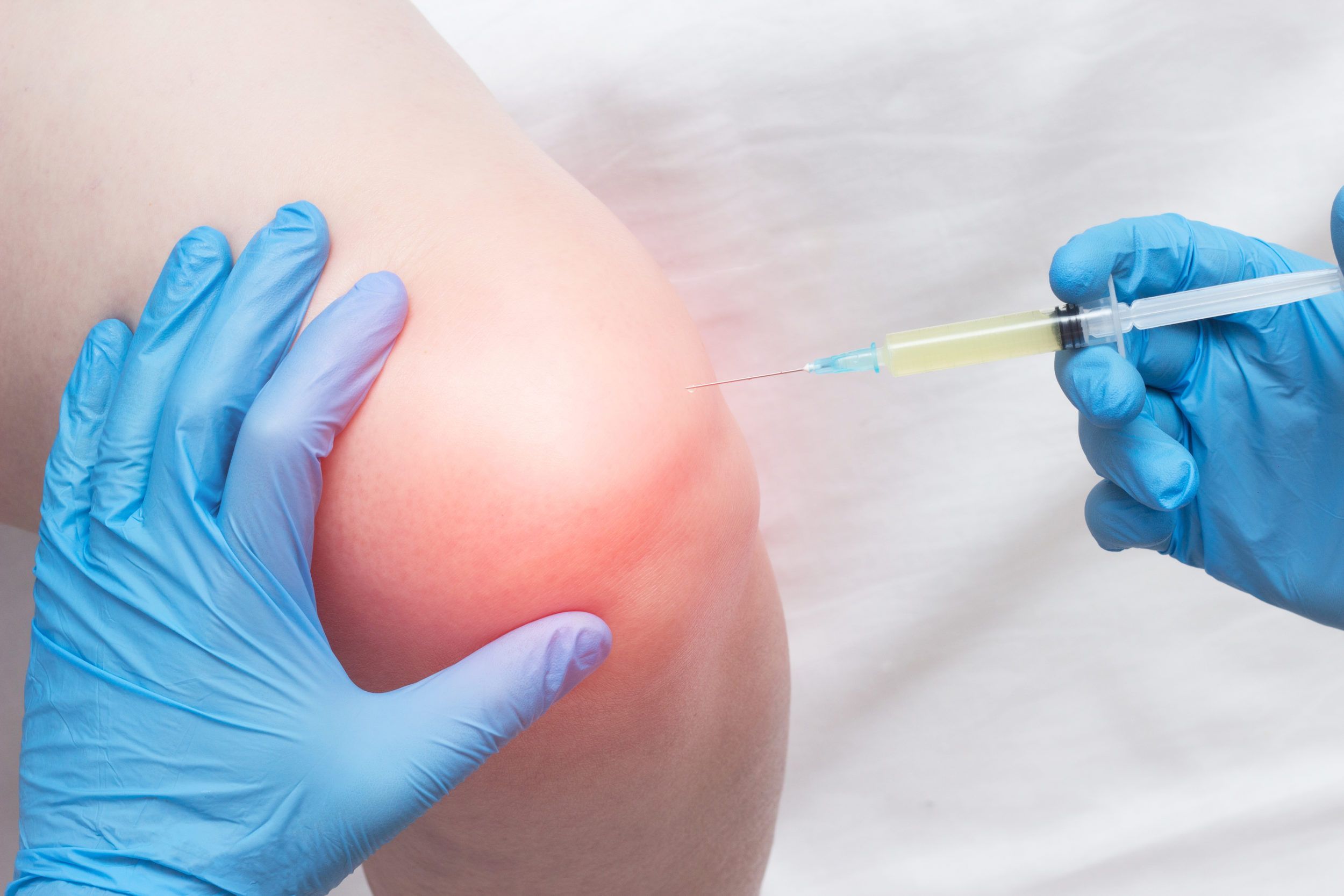Joint Pain Injections Market 2022 Size, Share & Forecast Report
