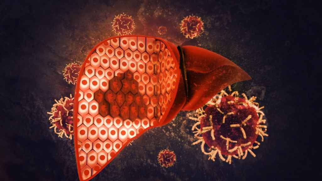 Key Considerations in Choosing a Liver Transplant Center