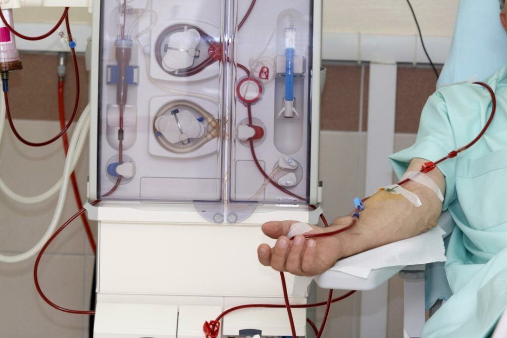 Kidney Dialysis Equipment and Supplies Market 2022 Analysis