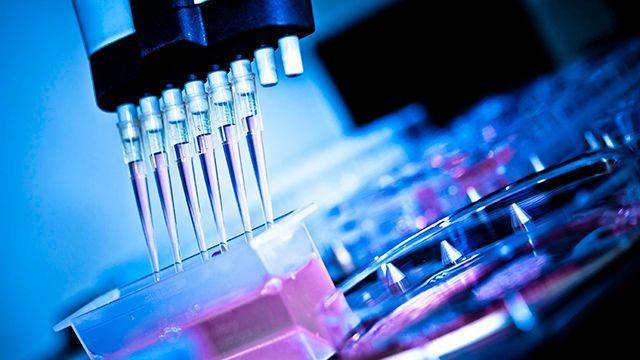 Laboratory Automation Market Size, Share - Industry Report 2028