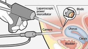 Laparoscopic Power Morcellators Market Landscape  2028