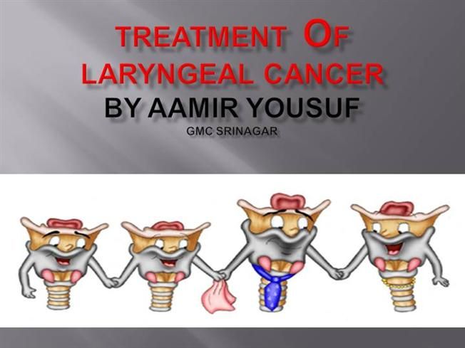 Laryngeal Cancer Therapeutics Market Research Report 