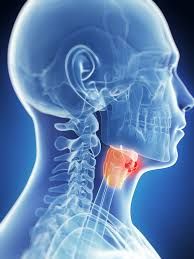 Laryngeal Cancer Therapeutics Market Size, Forecast to 2028