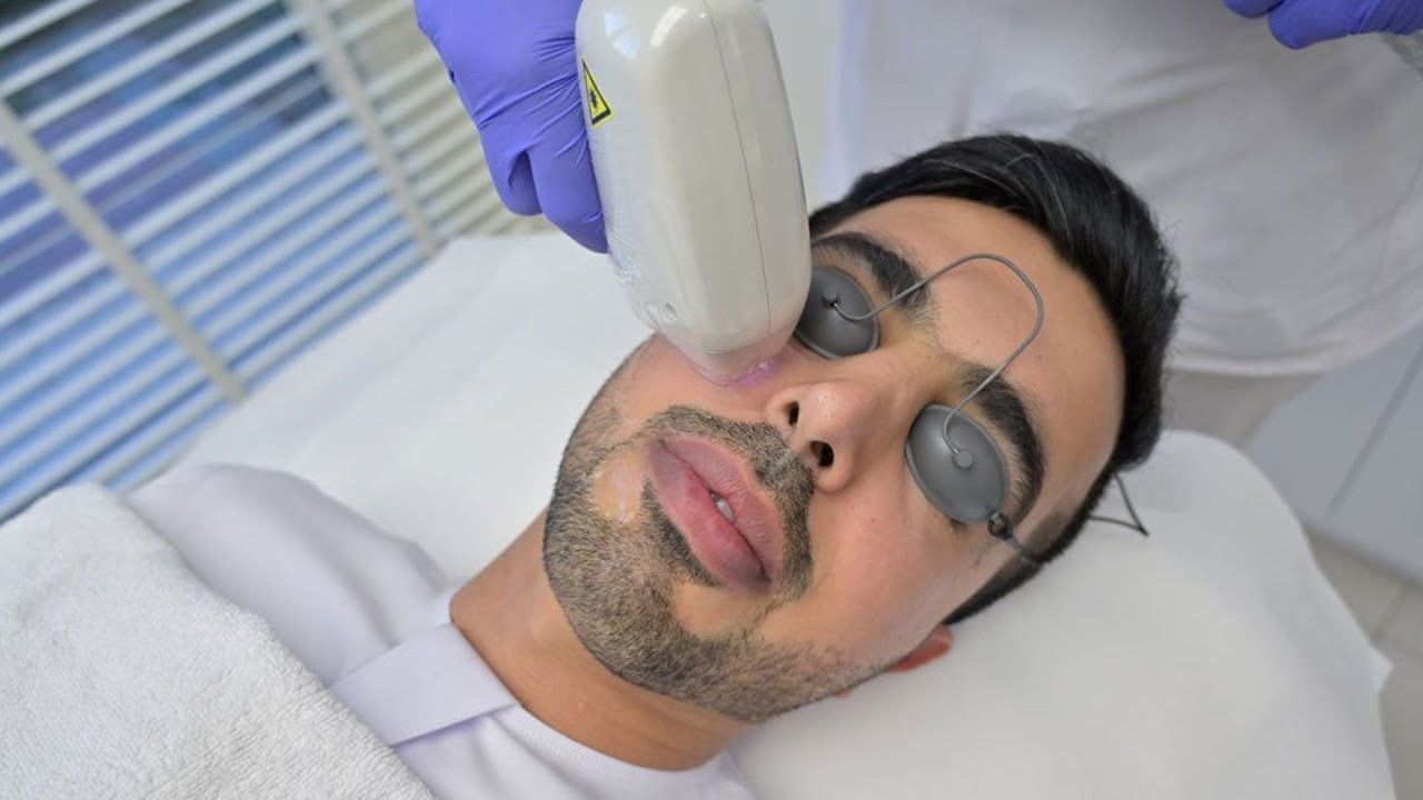Laser hair removal in Dubai: Beware of these common mistakes after your laser hair removal session in Dubai