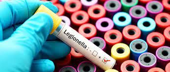 Legionella Testing Market Trends, Demand and Forecast to 2028